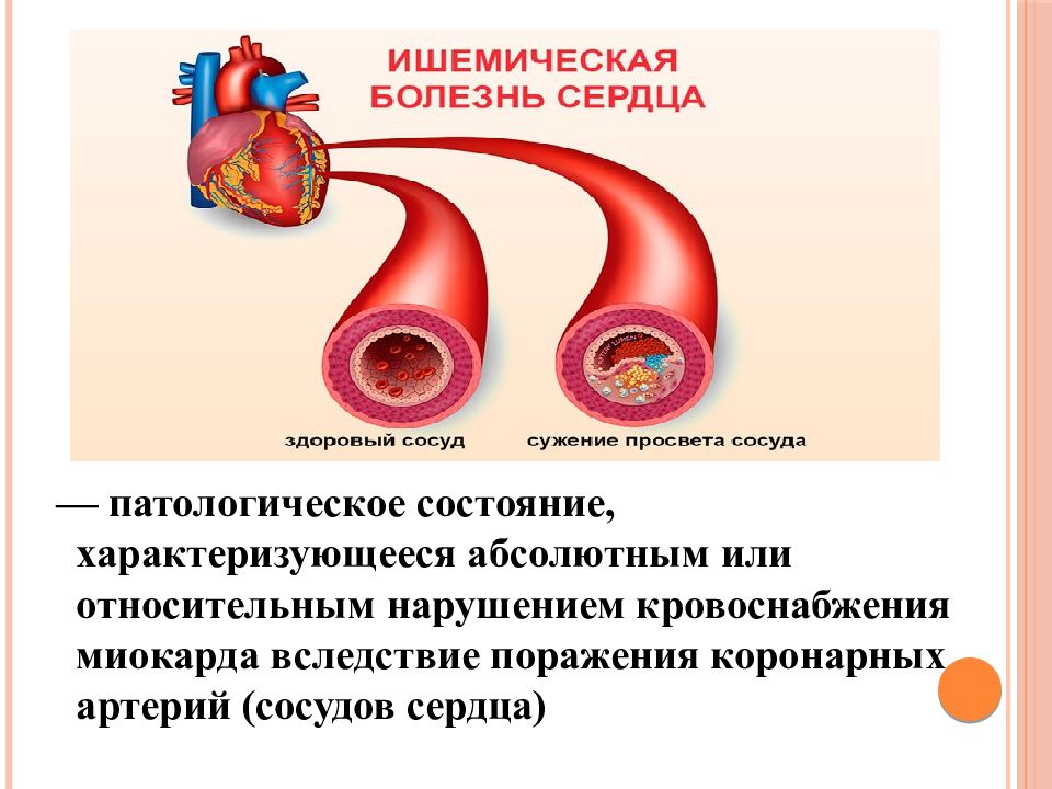 Первые признаки инфаркта у женщины симптомы 40. Признаки инфаркта. Инфаркт симптомы. Признаки инфаркта миокарда. Приступ миокарда симптомы.