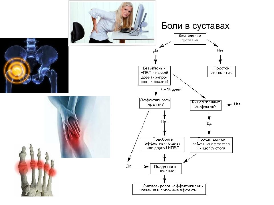 Ненаркотические анальгетики презентация