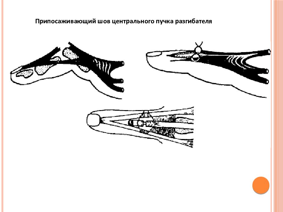 Повреждения плечевого пояса презентация