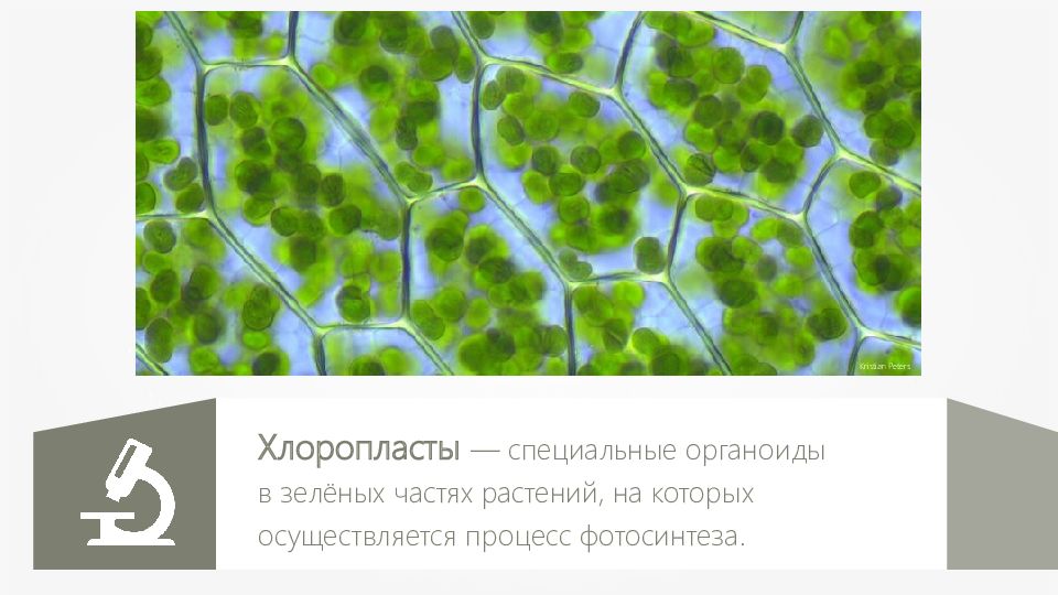 Хлоропласты в клетках листьев крупные. Хлоропласты в клетках листа традесканции под микроскопом. Хлоропласты в листе. Хлоропласт под микроскопом.