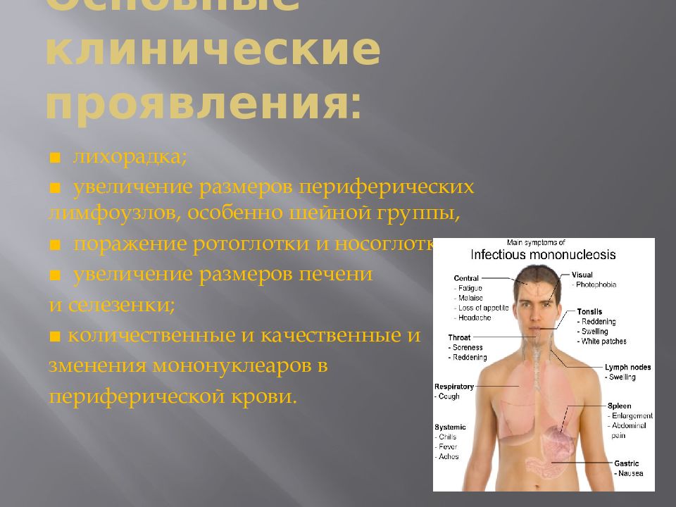 Инфекционный мононуклеоз клинические