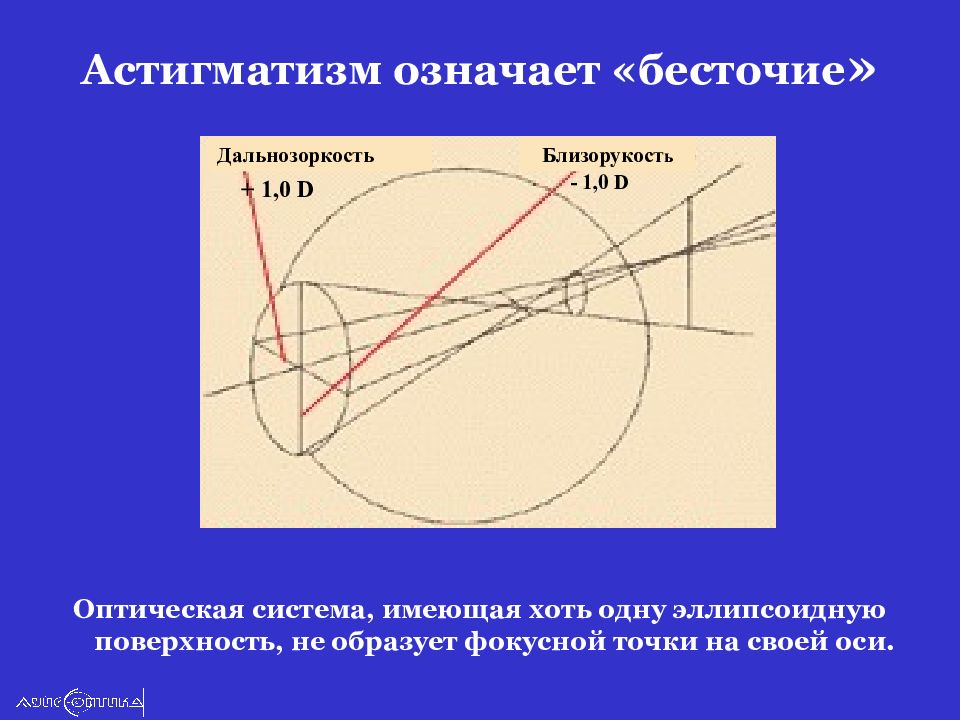 Астигматизм что. Астигматизм с косыми осями. Горизонтальный астигматизм. Астигматизм презентация. Астигматизм ось 170.