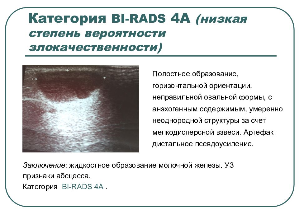 Ультразвуковая диагностика презентация