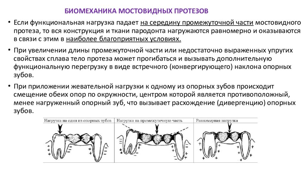 Изготовление мостовидных протезов презентация