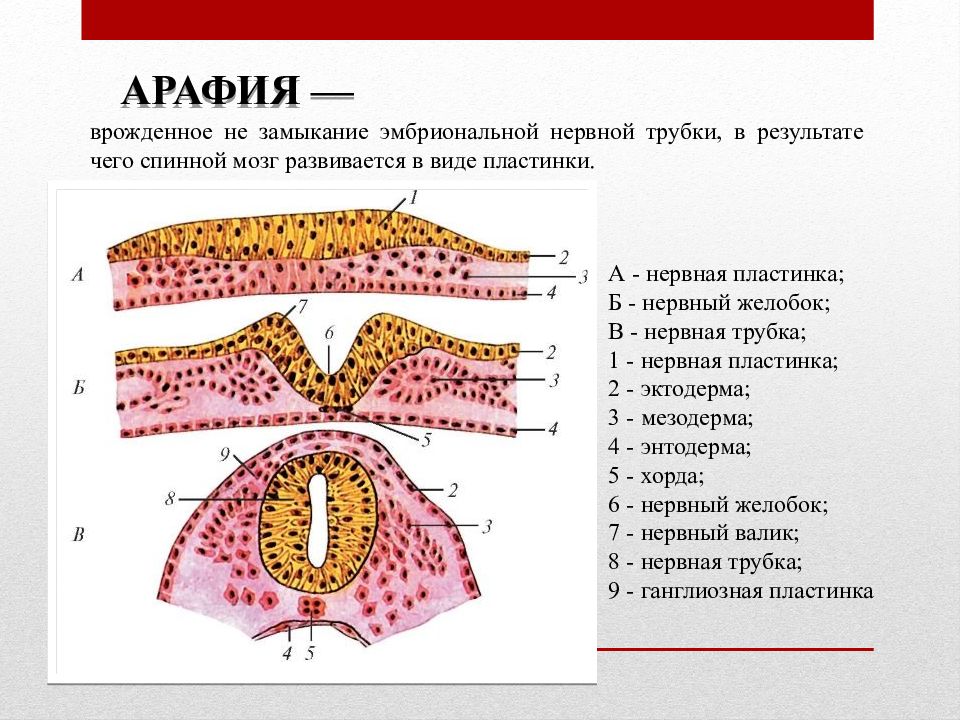 Нервная трубка. Дефекты развития нервной трубки. Пороки развития нервной трубки. Формирование нервной трубки. Что развивается из нервной трубки.