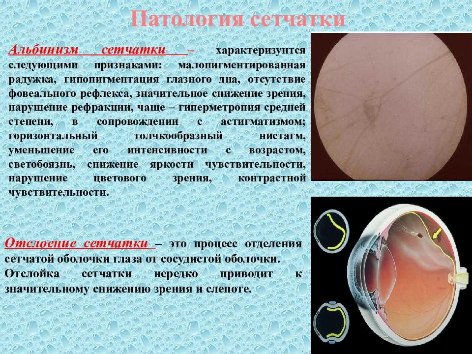 Анатомия физиология патология органов зрения