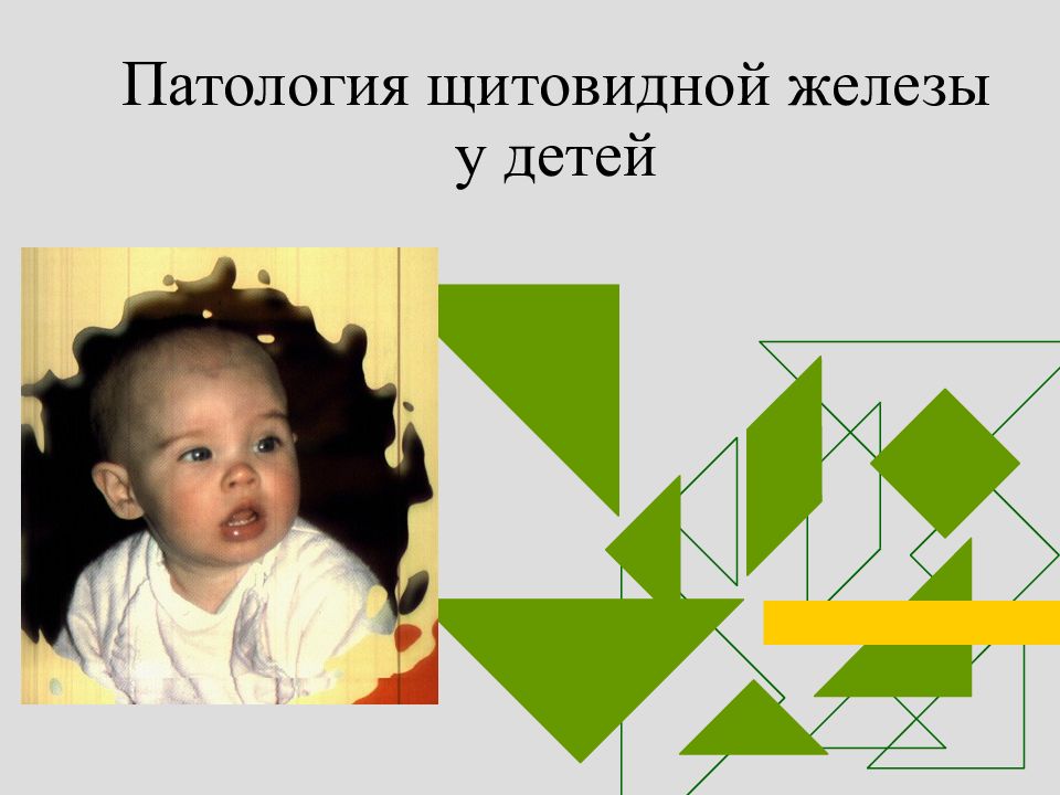 Патология щитовидной железы у детей