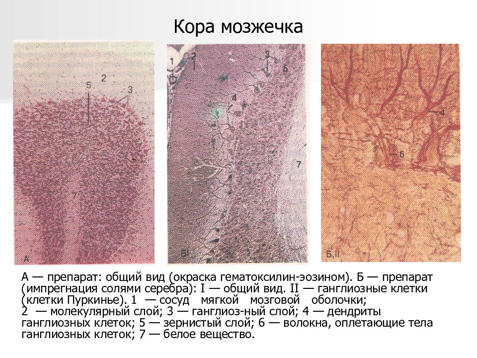 Мозжечок гистология рисунок