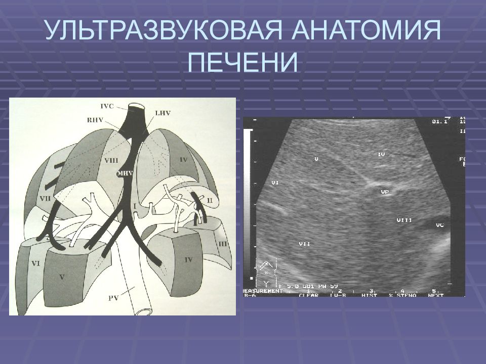 Сегменты печени на узи. УЗИ анатомия сегментов печени. Ультразвуковая анатомия печени. Ультразвуковые сегменты печени.