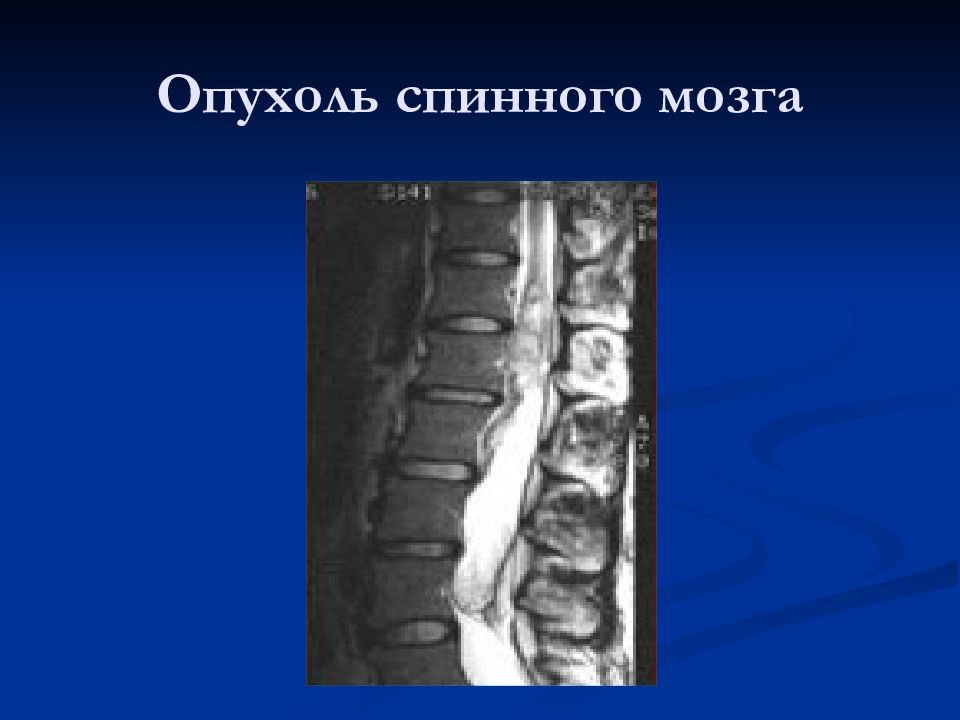 Лучевая диагностика в неврологии презентация