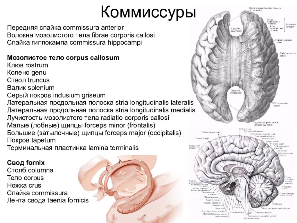 Лента свода. Мозолистое тело и свод мозга. Комиссура Антериор. Комиссура гиппокампа. Мозолистое тело свод анатомия.