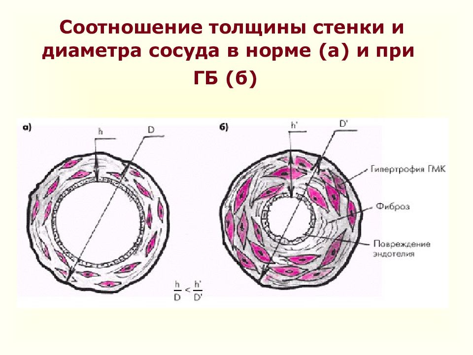 Ісіну синдромы презентация