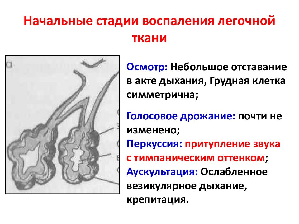 Легочная ткань