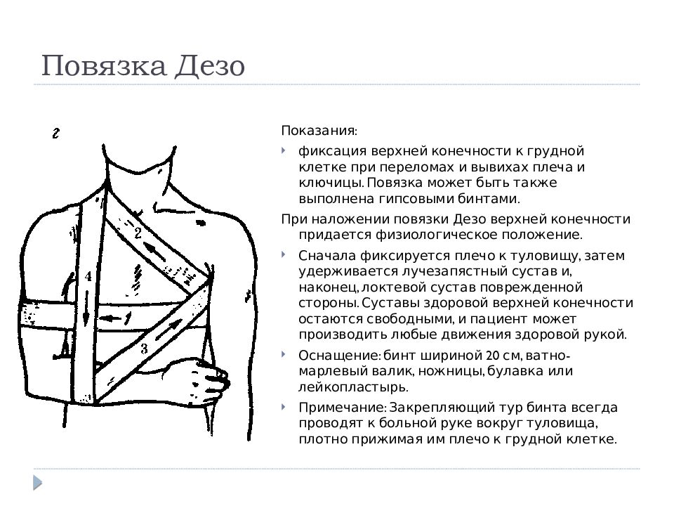 Повязка дезо при переломе плеча