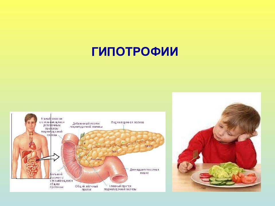 ГИПОТРОФИИ
