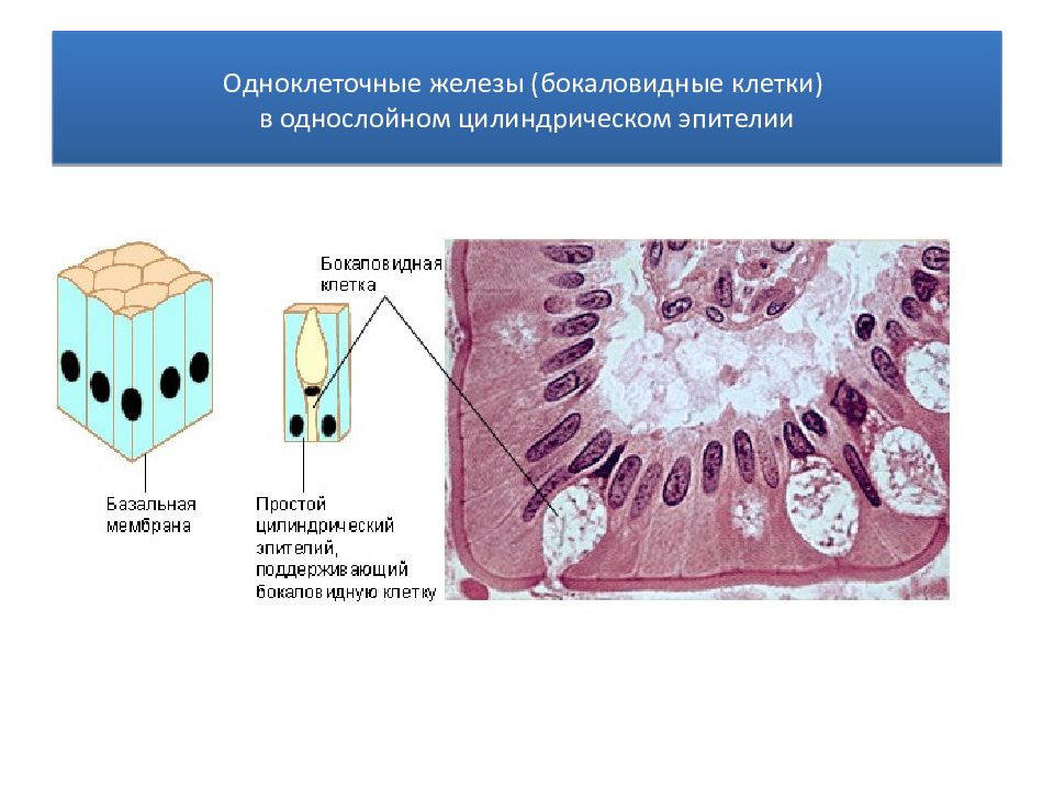 Бокаловидные клетки