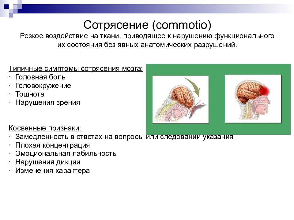 Симптомы сотрясения мозга у ребенка