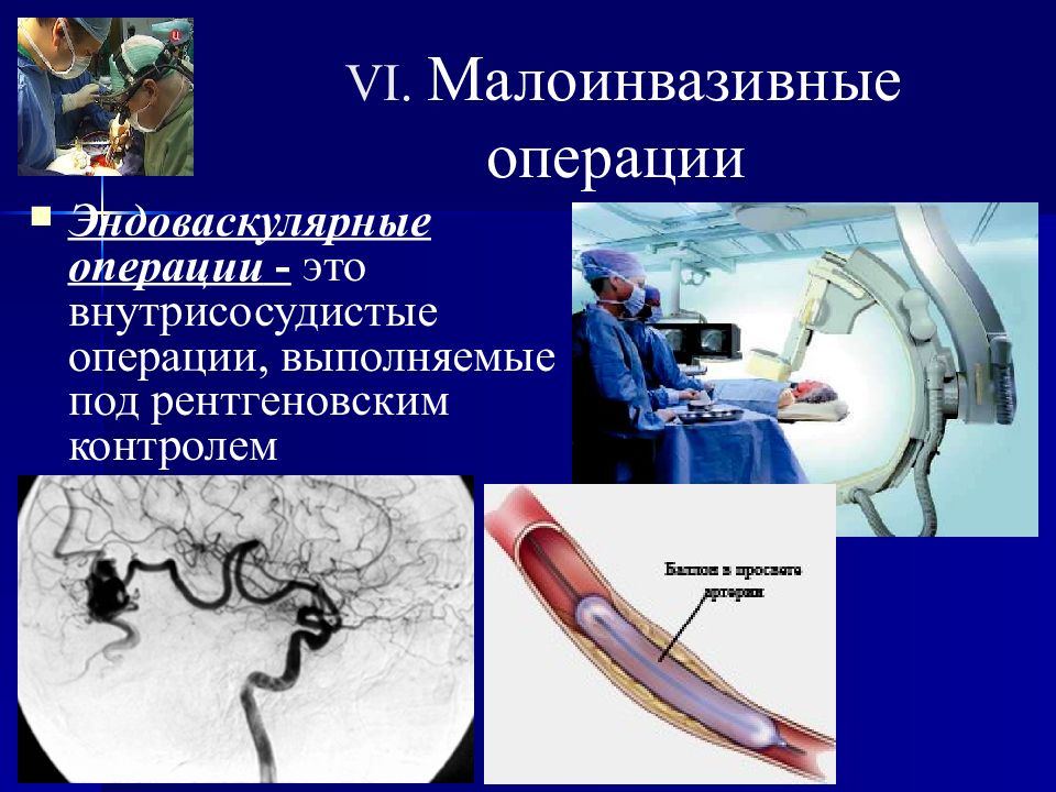 Малоинвазивная хирургия презентация