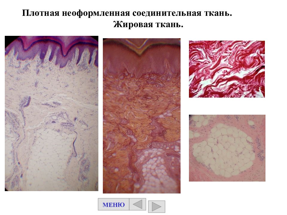 Плотная неоформленная соединительная ткань. Плотная неоформленная соединительная ткань препарат. Плотная неоформленная соединительная ткань жировая ткань. Плотная неоформленная волокнистая соединительная ткань кожи пальца. Плотная неоформленная соед ткань.