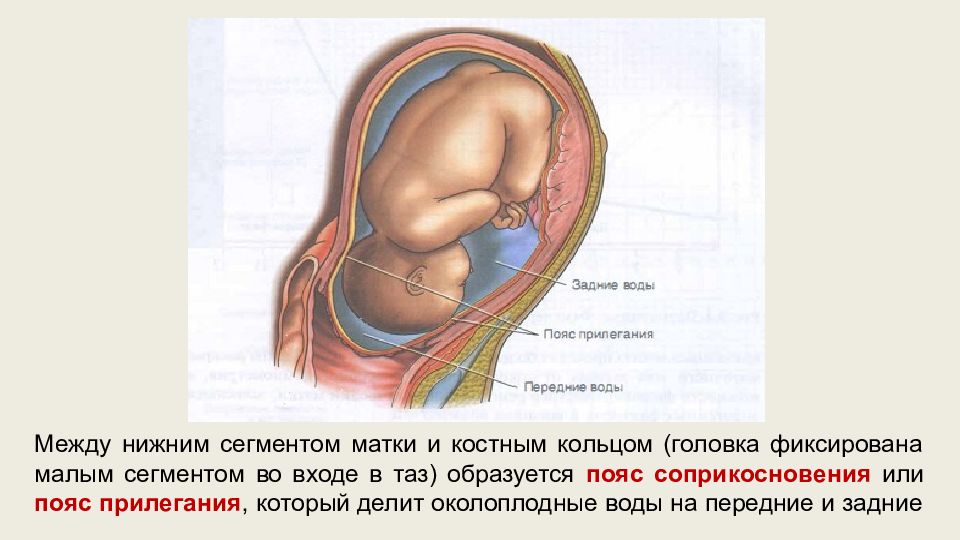 Контракционное кольцо в акушерстве. Пояса соприкосновения плодного пузыря. Пояс соприкосновения в акушерстве.