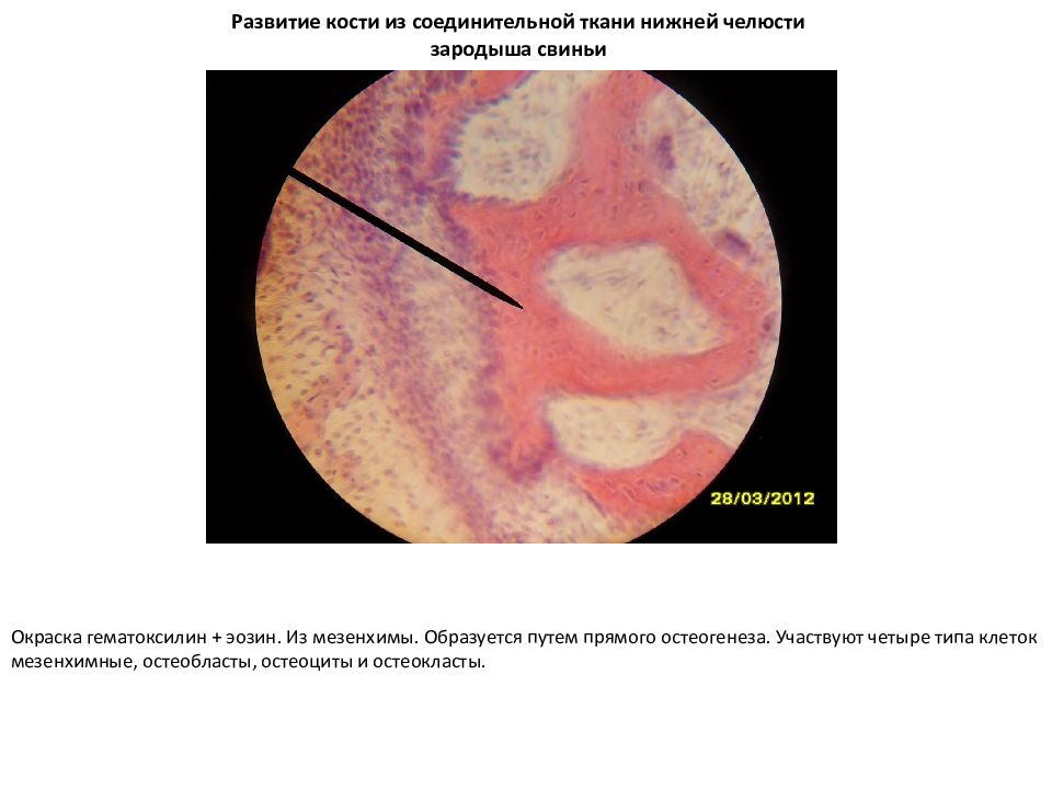 Прямой остеогенез гистология рисунок