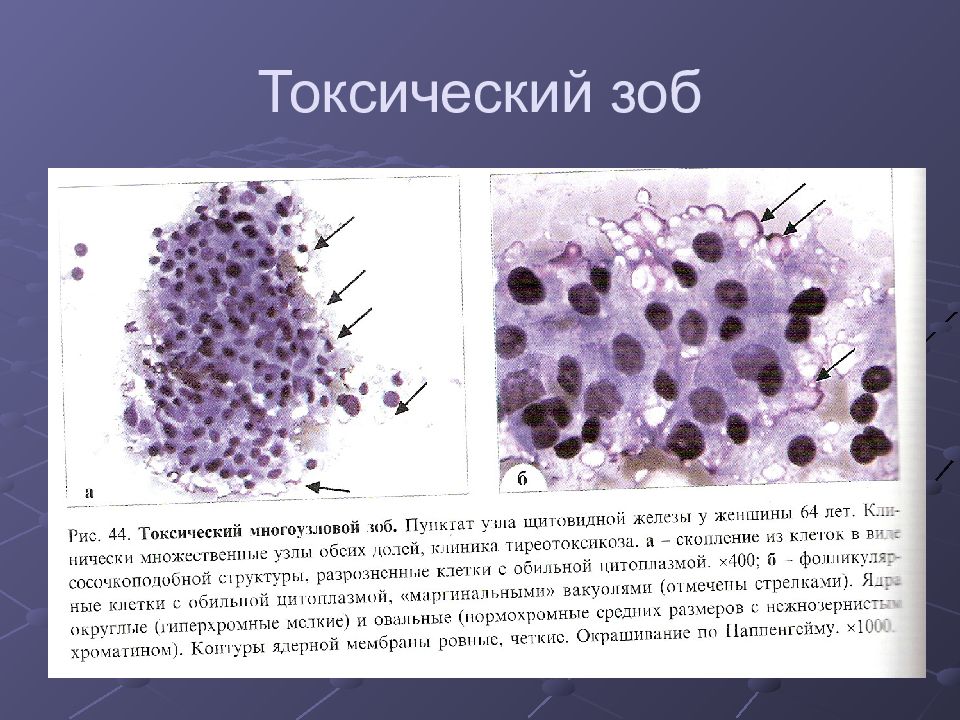 Цитологическая диагностика заболеваний молочной железы презентация