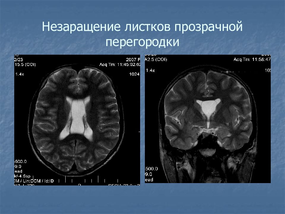 Полость прозрачной перегородки