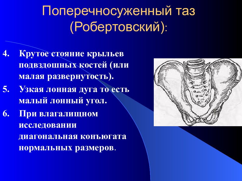 Диагональная конъюгата в акушерстве