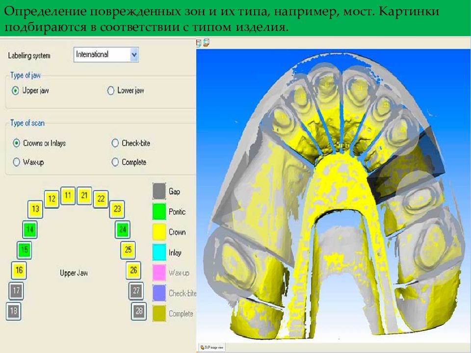 Cad cam технологии в ортопедической стоматологии презентация