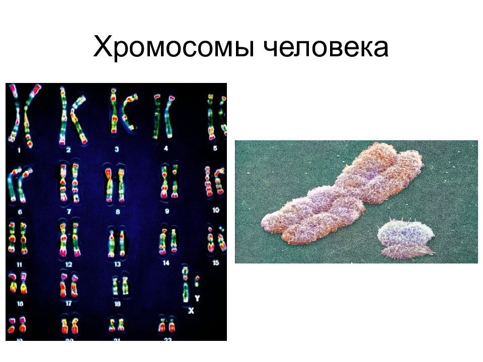 Хромосомы лучше видны. Хромосомы человека. Как выглядит хромосома человека. Хромосомные человека.