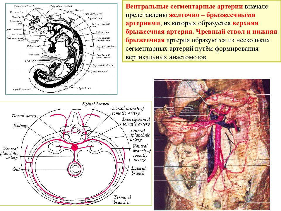 Верхняя брыжеечная артерия анатомия кт. Ветви чревного ствола схема. Чревный ствол верхняя брыжеечная. Чревный ствол схема.
