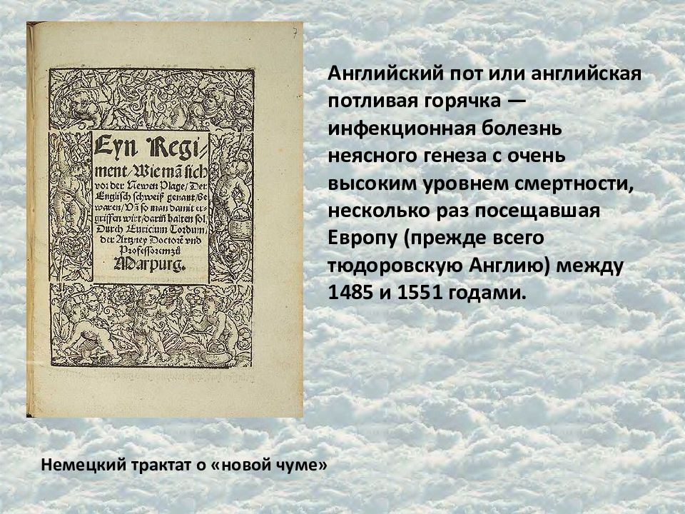 Потница в средневековой англии. Английская потовая горячка средневековье. Английский пот болезнь. Английская потовая болезнь. Английский пот эпидемия.