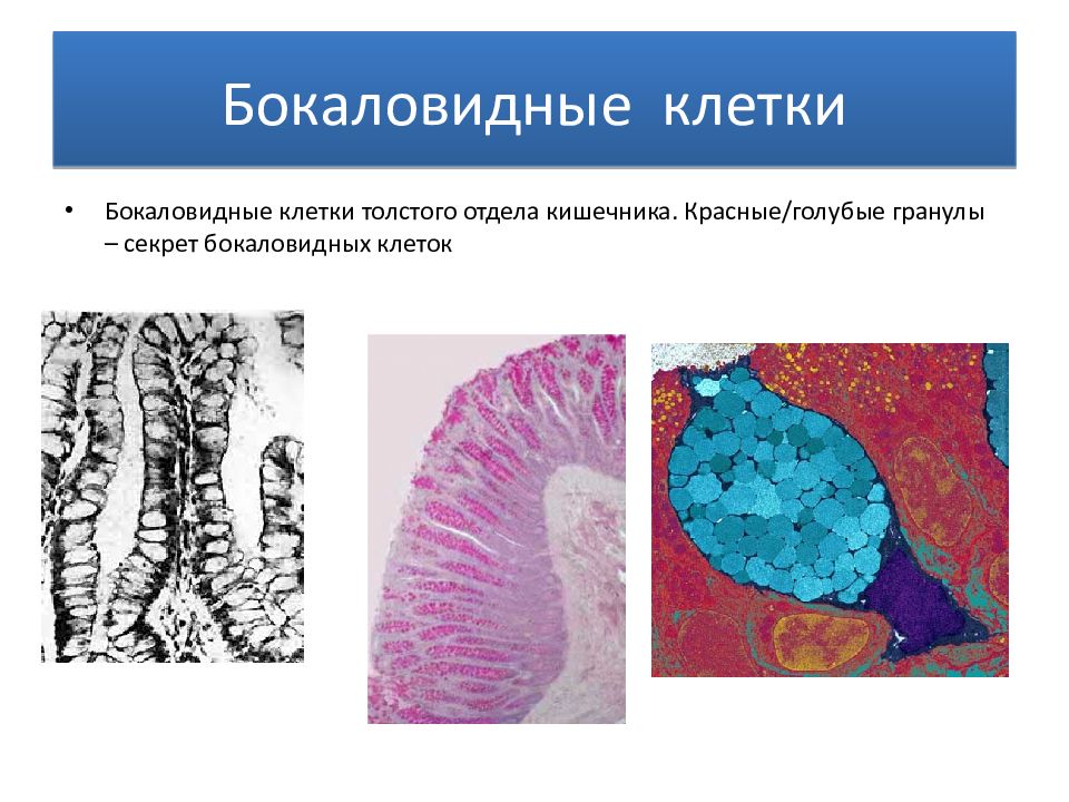 Бокаловидные клетки. Бокаловидные клетки эпителия тонкой кишки. Бокаловидные клетки вырабатывают секрет. Бокаловидные экзокриноциты. Бокаловидные клетки кишечника гистология.