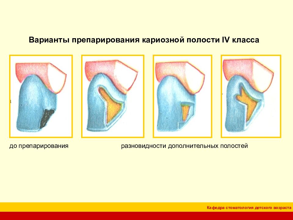 4 класс по блэку презентация