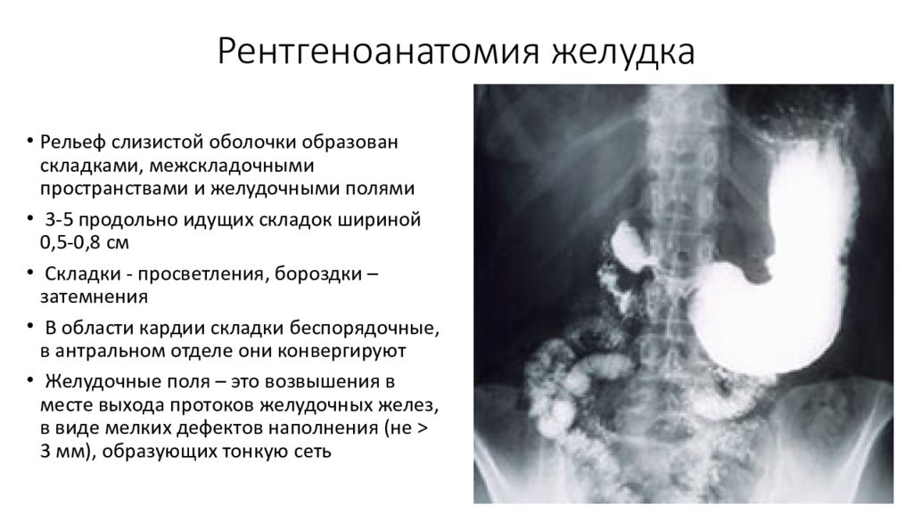 Рентгеноанатомия жкт презентация