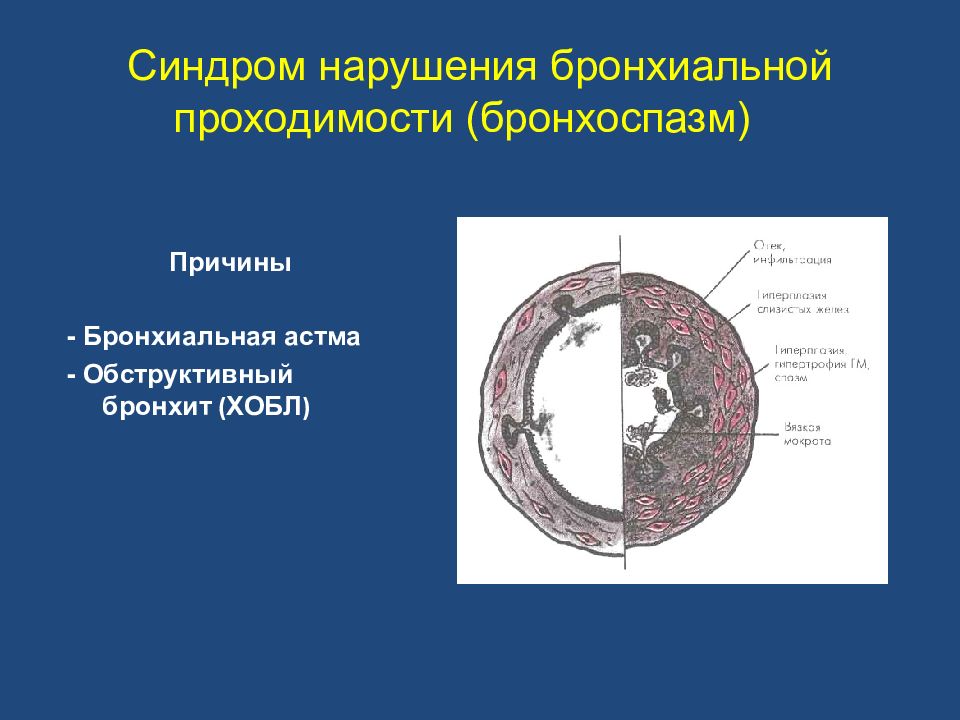 Синдром нарушений. Синдром нарушения бронхиальной проходимости. Синдром нарушения бронхиальной проходимости (синдром бронхоспазма. Синдром острого нарушения бронхиальной проходимости. Синдром нарушения проходимости бронхов.