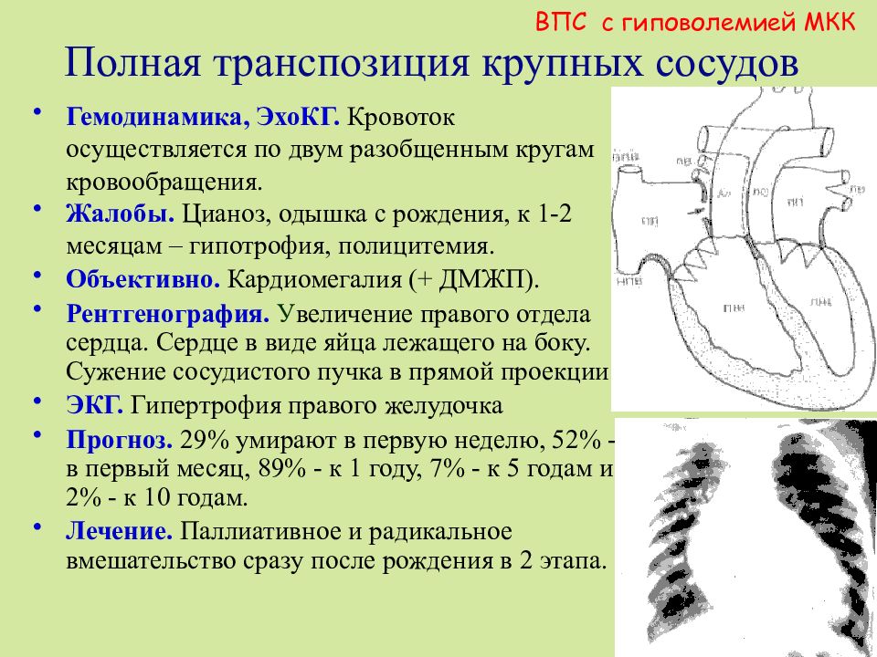 Белые пороки сердца у детей презентация