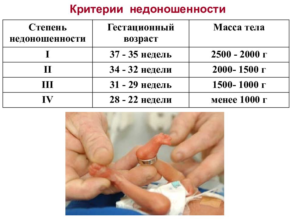 Недоношенные дети презентация педиатрия