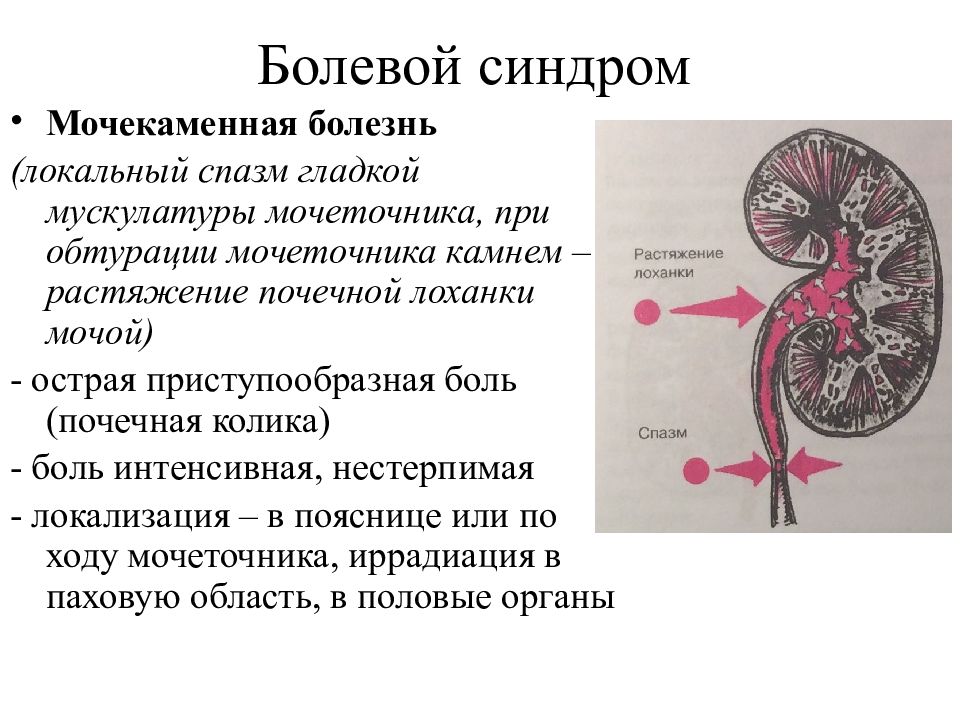 Презентация по мочекаменной болезни