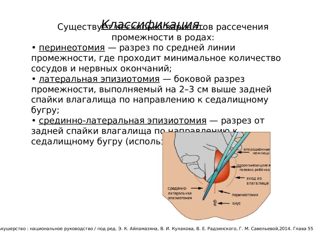 Перинеотомия и эпизиотомия презентация