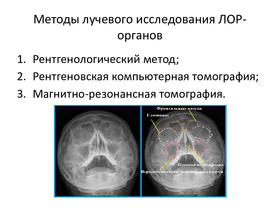 Методы исследования лор органов презентация