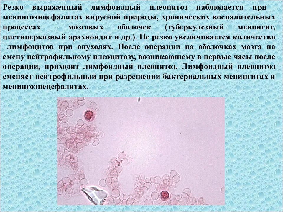 Исследование ликвора презентация