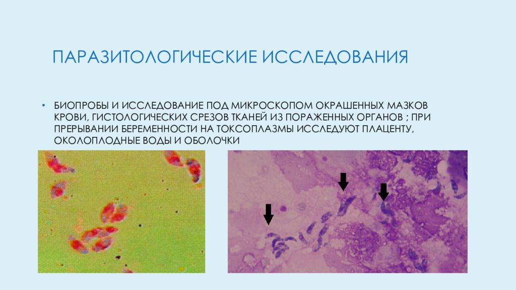 Презентация токсоплазмоз при беременности