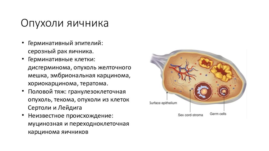Карцинома яичников что это. Патогенез опухолей яичников. Карцинома яичников что это. Злокачественные новообразования яичников. Характерная особенность злокачественных опухолей яичников.