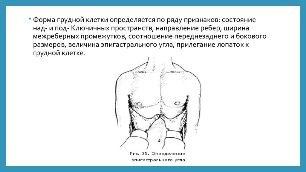 Глубина грудной клетки. Эпигастральный угол. Как определить форму грудной клетки. Эпигастральный угол как определить. Соотношение передне-заднего и бокового размеров грудной клетки.