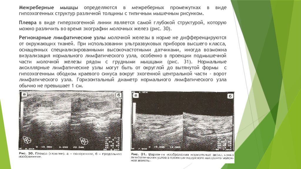 Аксиллярный лимфоузел молочной железы что это такое. УЗИ молочной железы презентация. УЗИ молочных/грудных желёз и регионарных лимфатических узлов. УЗИ молочных желез с регионарными лимфоузлами. Гипоэхогенные лимфатические узлы.