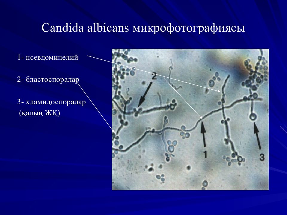 Соскоб на мицелий. Candida albicans бластоспоры. Псевдомицелий в почве. Псевдомицелий и мицелий отличия. Псевдомицелий кандида в пищеводе.