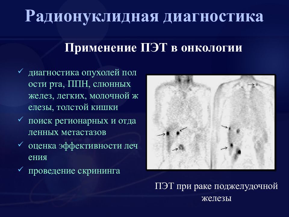 Радионуклидная диагностика. Радионуклидная диагностика опухоли. Радионуклидное исследование легких. Радионуклидные методы исследования в онкологии. Радионуклидный способ лучевой диагностики.