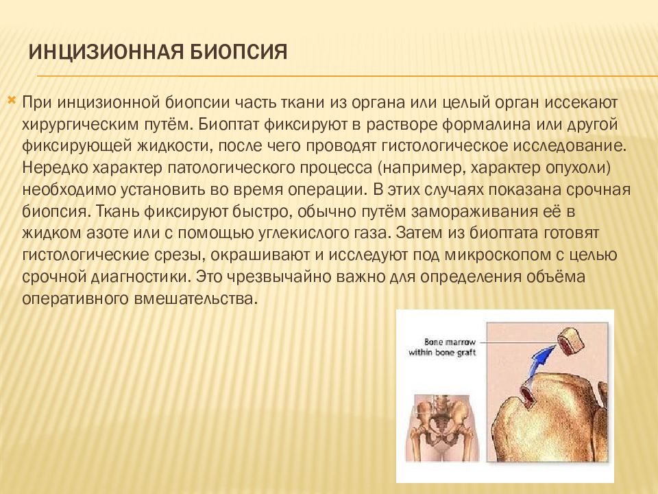 Тонкоигольная биопсия. Что такое на биопсия это. Методы исследования материала биопсии. Пункционная биопсия почек показания. Тонкоигольная аспирационная пункционная биопсия.