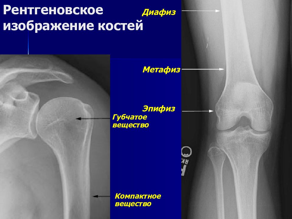 Схема длинной трубчатой кости взрослого человека и ребенка рентген